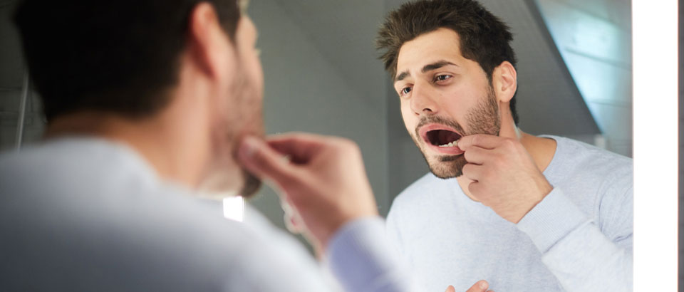 man examining mouth for sore