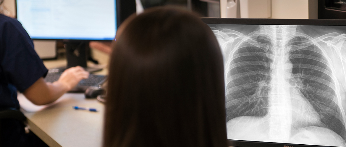 a MedExpress provider examines an X-ray image
