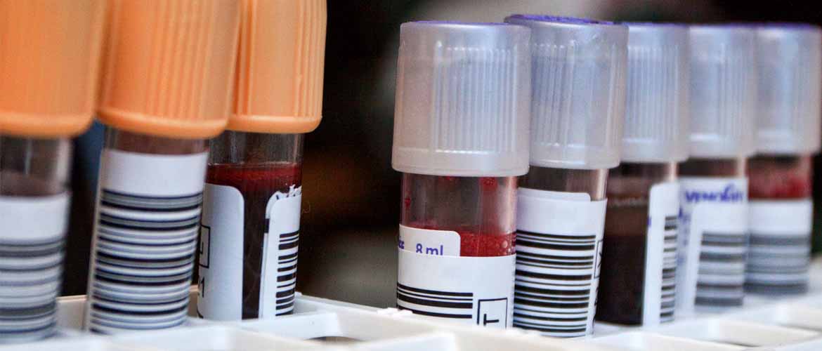 vials of blood in a laboratory