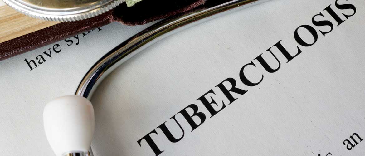 a stethoscope laying across a piece of paper that says tuberculosis