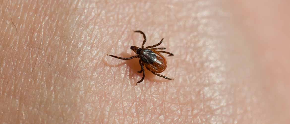 a tick on human skin